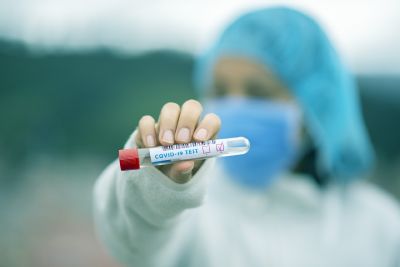 Nemocnice Nový Jičín začne nově testovat na SARS-CoV-2 také samoplátce
