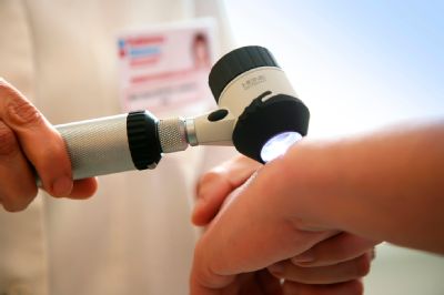 Rakovinu kůže pomáhá odhalit v Nemocnici AGEL Nový Jičín preventivní vyšetření znamének